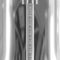 Electric 100 Cup Commercial Coffee Percolator in Stainless Steel